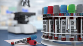 Ardena Strengthens Bioanalytical Capabilities with Operational Launch of New Oss Laboratory