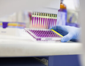 Ardena Strengthens Bioanalytical Capabilities with Operational Launch of New Oss Laboratory